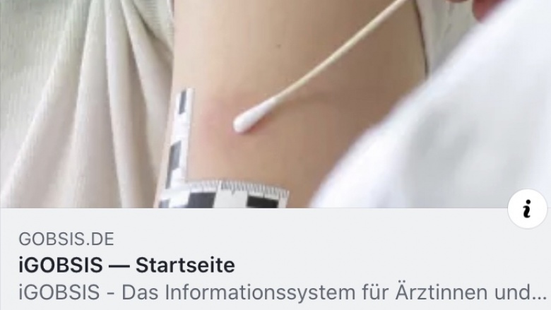 Beweissicherung Beweissicherung
